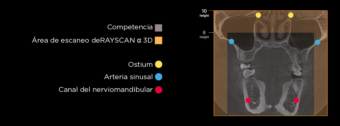 Dentición Completa