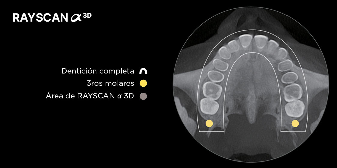 Dentición Completa