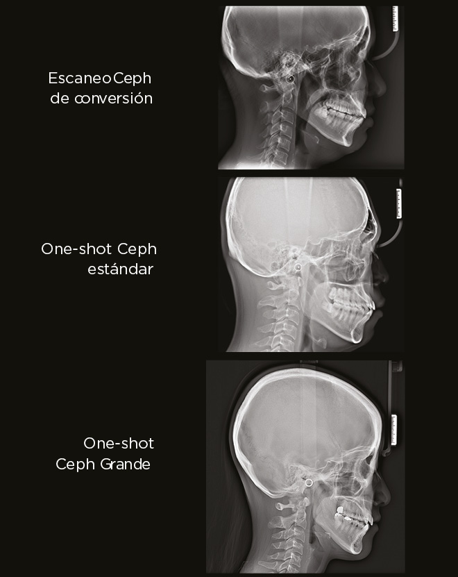 Modalidad Ceph Opcional