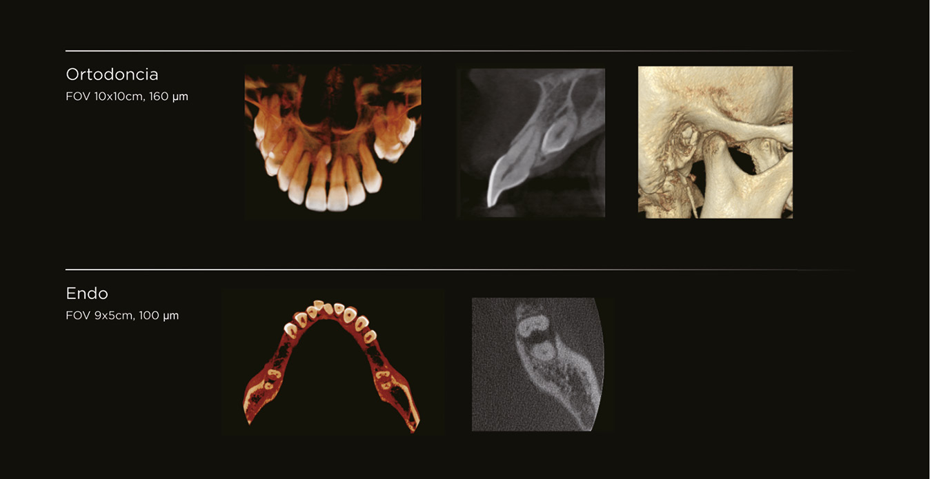 Ortodoncia y Endodoncia