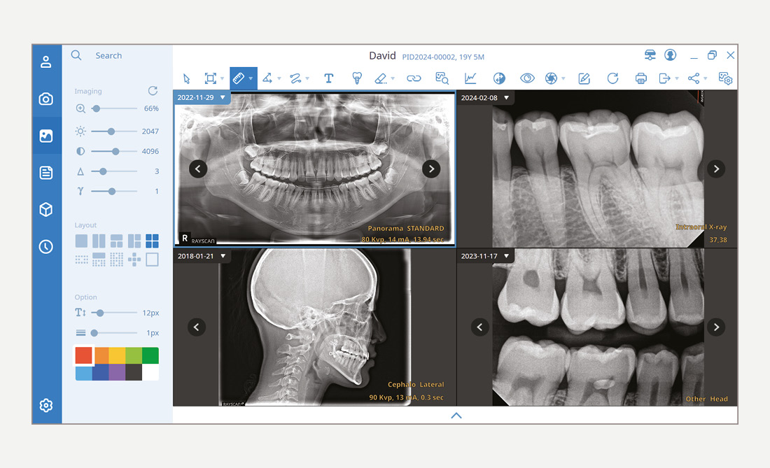 SMARTDent Software 2D