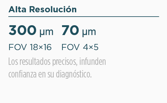 Alta Resolución