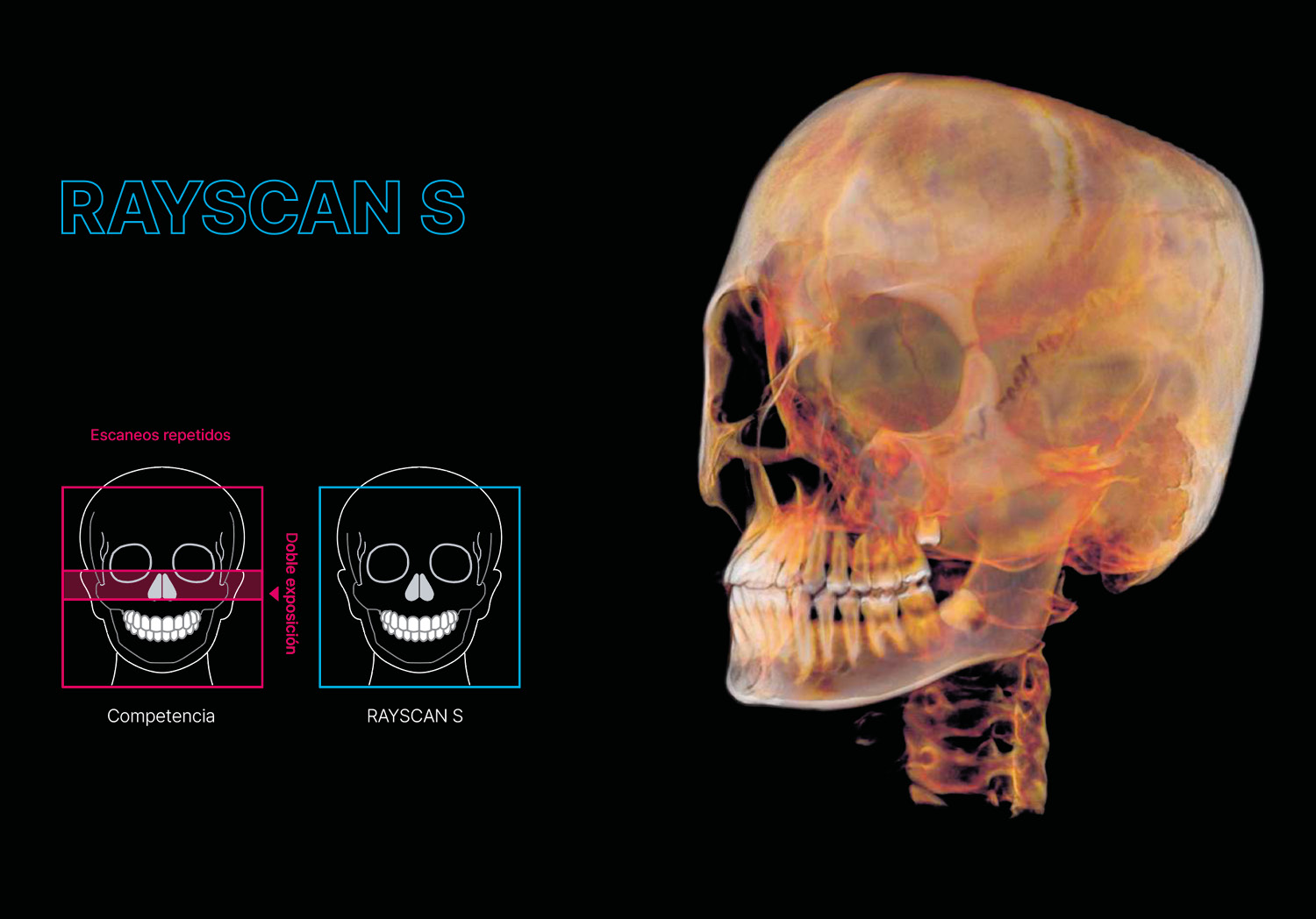 Sensor a tamaño real RAYSCAN S